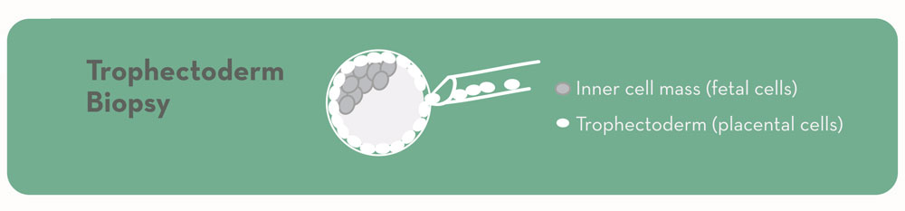 Trophectoderm Biopsy